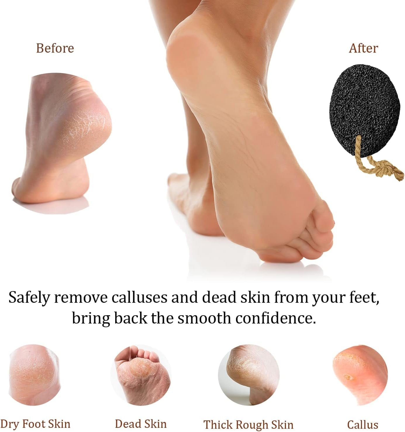 Natural Lava Pumice Stone - Ultimate Callus & Corn Remover for Smooth Feet and Heels - Exfoliating Pedicure Tool for Healthy Skin Care